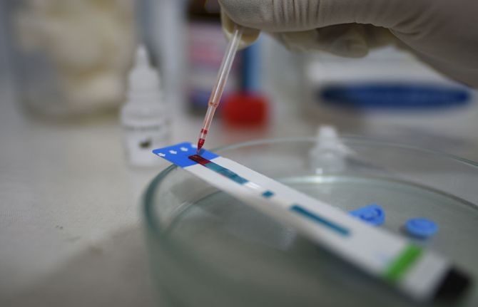 HIV testing. Credit: UNAIDS HIV testing. Credit: UNAIDS
